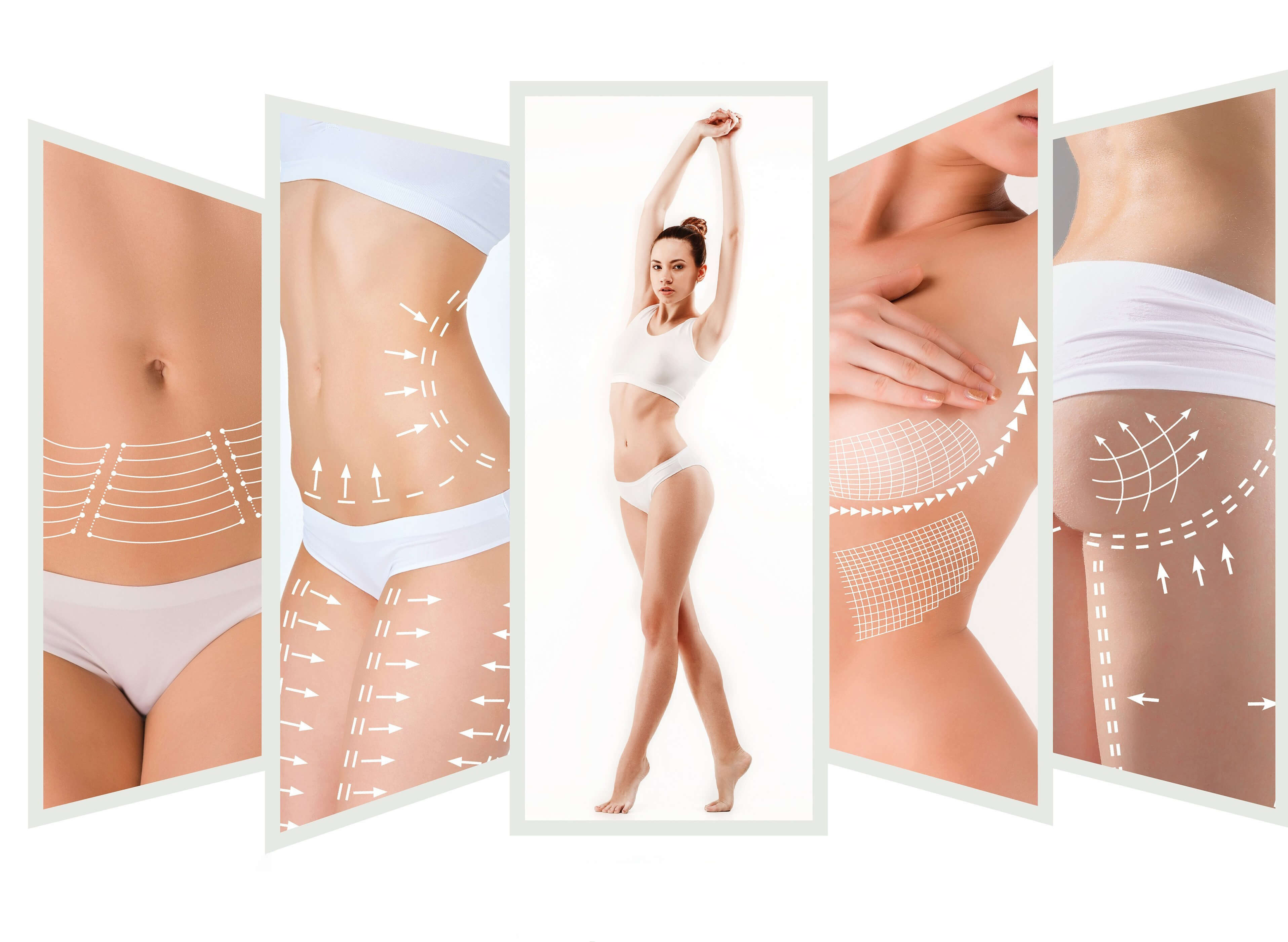 RADIOFREQUENCY BODY CONTOURING body areas salon toujours belle